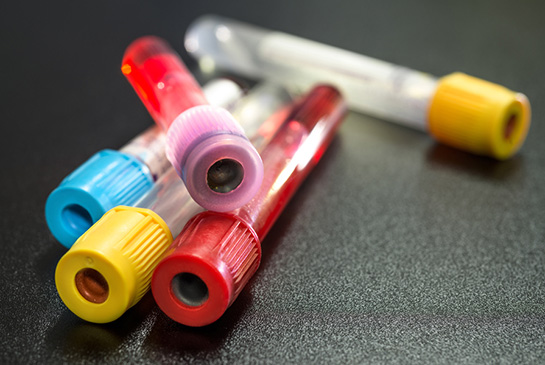 Lab draw vials